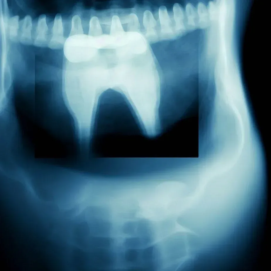 Zdjęcie RTG zęba w ciąży